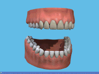 In Surgery Teeth