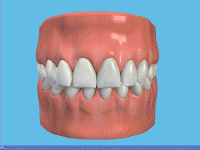 A Dental Bridge