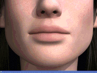 Cosmetic Contouring